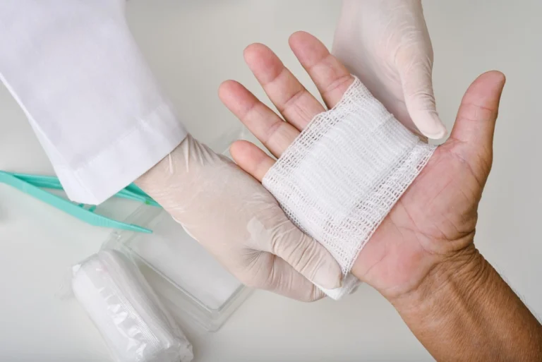 Treating wound