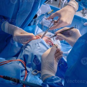 surgical-procedure-in-action-close-up-view-2023-photo Dermatology Services - A patient getting facial sugery